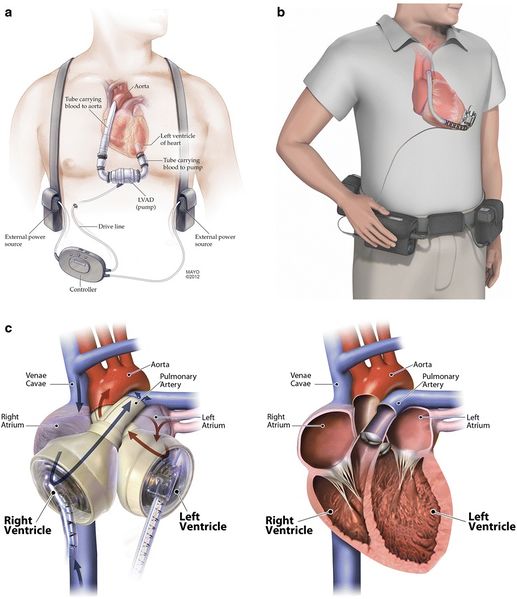 File:13054 2016 1328 Fig2 HTML.jpg